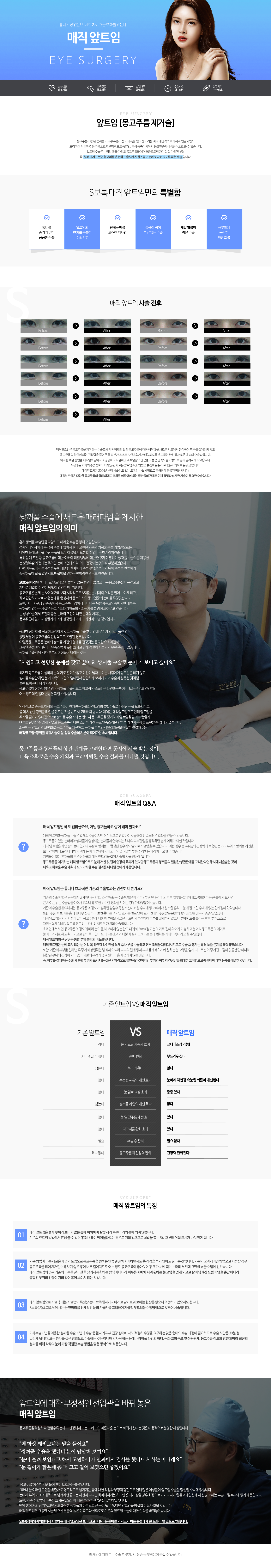 매직앞트임