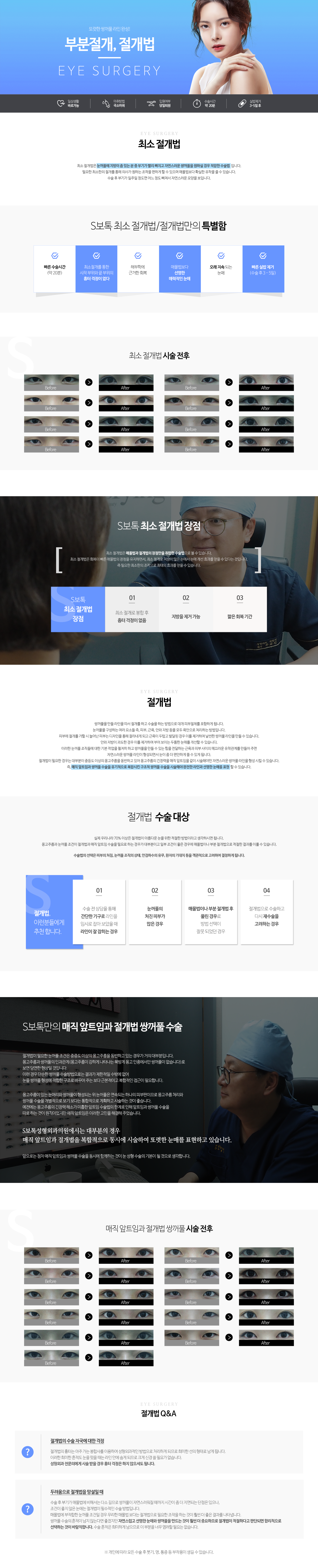 부분절개와 절개법